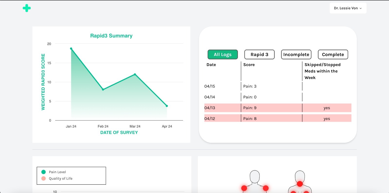 Rheumote screenshot 2