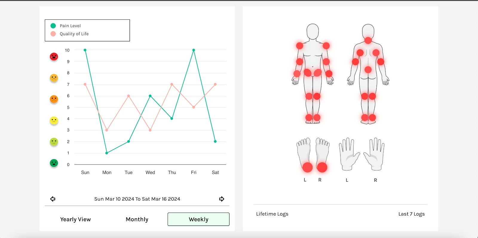 Rheumote screenshot 5